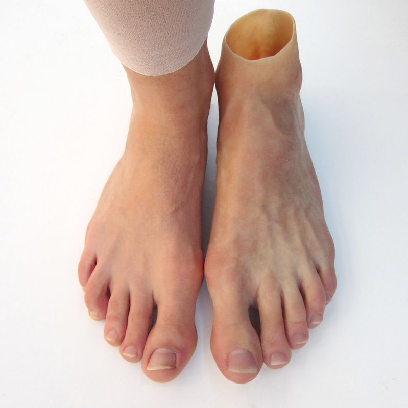 Partial Foot Prosthetics In Ar With Partial Foot Prosthetics In Ar Umes