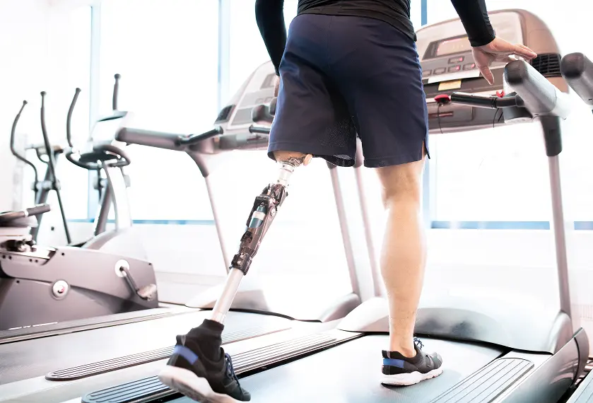 How to Support an Amputee’s Journey